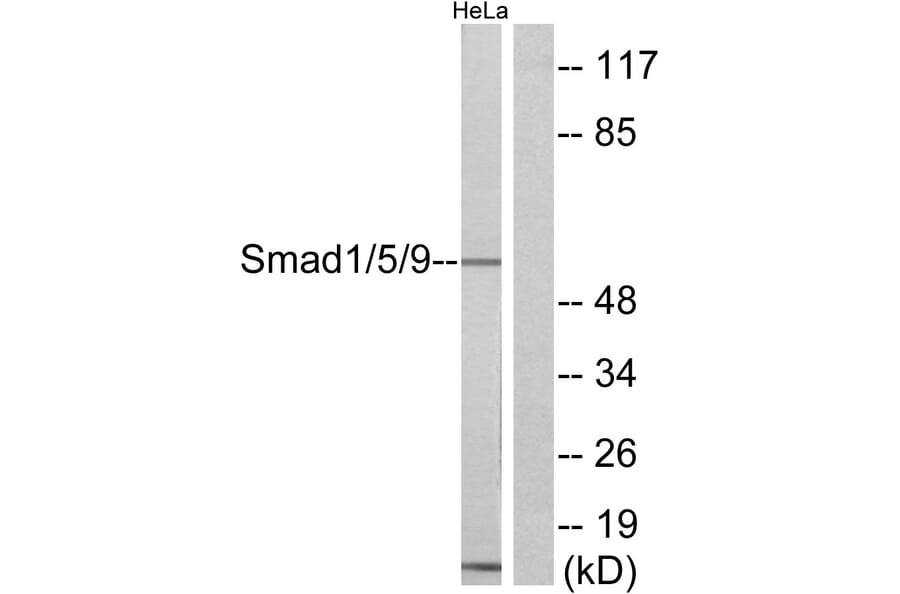 Western Blot - Anti-Smad1 + Smad5 + Smad9 Antibody (C11110) - Antibodies.com