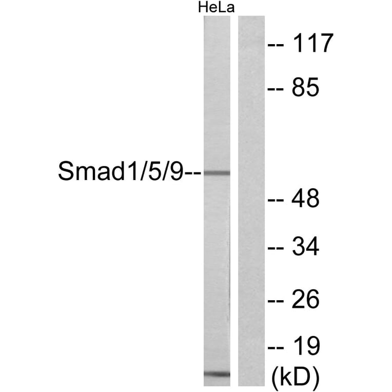 Western Blot - Anti-Smad1 + Smad5 + Smad9 Antibody (C11110) - Antibodies.com