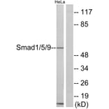 Western Blot - Anti-Smad1 + Smad5 + Smad9 Antibody (C11110) - Antibodies.com
