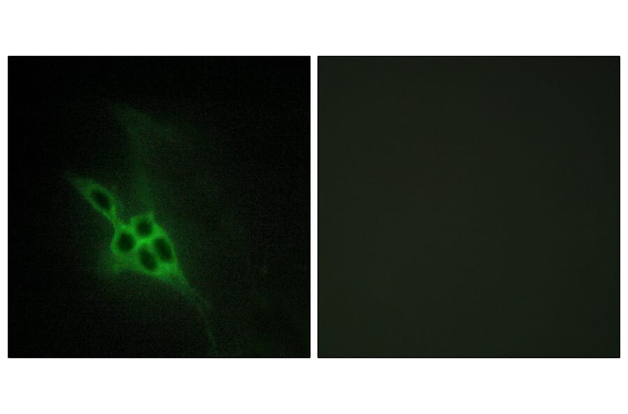 Immunofluorescence - Anti-EPHB1 + EPHB2 + EPHB3 Antibody (C15651) - Antibodies.com
