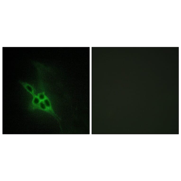 Immunofluorescence - Anti-EPHB1 + EPHB2 + EPHB3 Antibody (C15651) - Antibodies.com