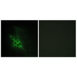 Immunofluorescence - Anti-EPHB1 + EPHB2 + EPHB3 Antibody (C15651) - Antibodies.com