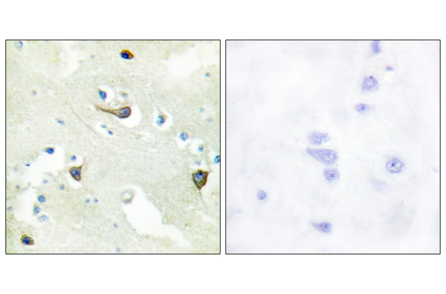 Immunohistochemistry - Anti-EPHB1 + EPHB2 + EPHB3 Antibody (C15651) - Antibodies.com