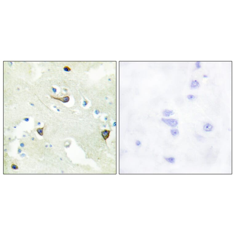 Immunohistochemistry - Anti-EPHB1 + EPHB2 + EPHB3 Antibody (C15651) - Antibodies.com