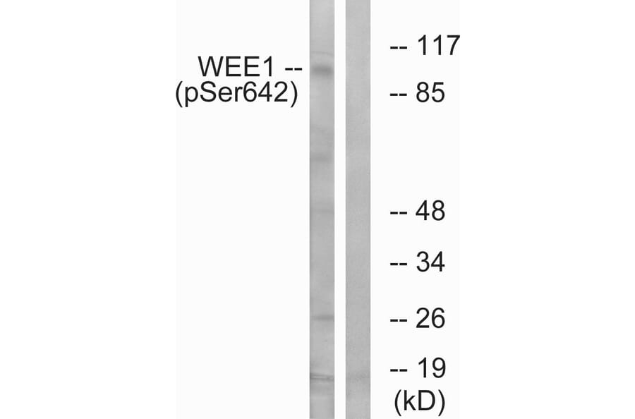 Western Blot - Anti-WEE1 (phospho Ser642) Antibody (A1186) - Antibodies.com