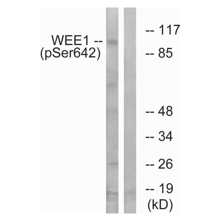 Western Blot - Anti-WEE1 (phospho Ser642) Antibody (A1186) - Antibodies.com