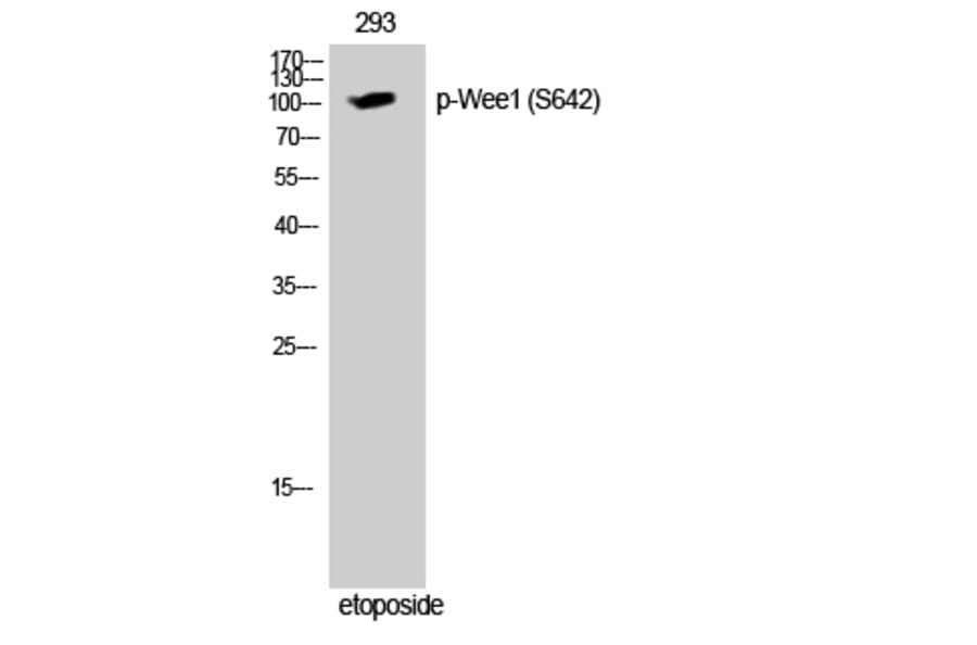 Western Blot - Anti-WEE1 (phospho Ser642) Antibody (A1186) - Antibodies.com