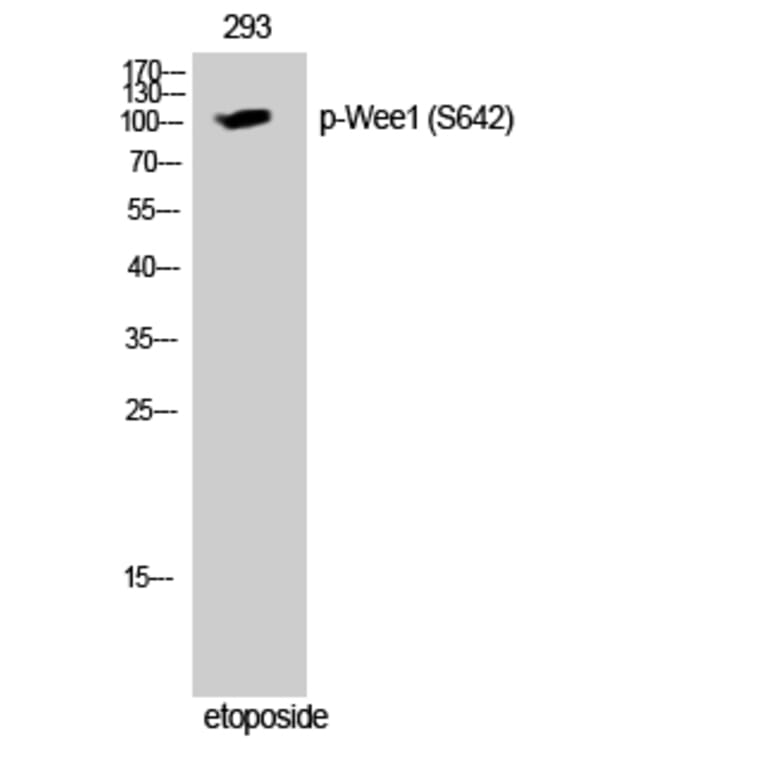 Western Blot - Anti-WEE1 (phospho Ser642) Antibody (A1186) - Antibodies.com