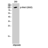 Western Blot - Anti-WEE1 (phospho Ser642) Antibody (A1186) - Antibodies.com