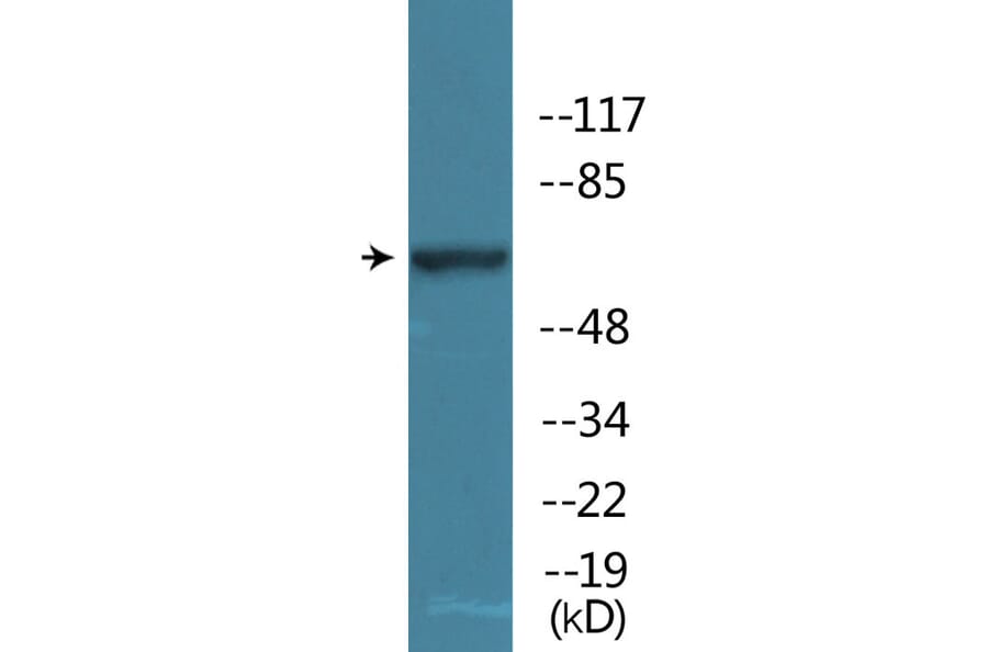 Western Blot - Anti-WEE1 (phospho Ser642) Antibody (P12-1198) - Antibodies.com