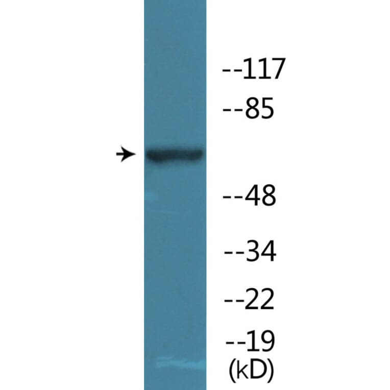 Western Blot - Anti-WEE1 (phospho Ser642) Antibody (P12-1198) - Antibodies.com