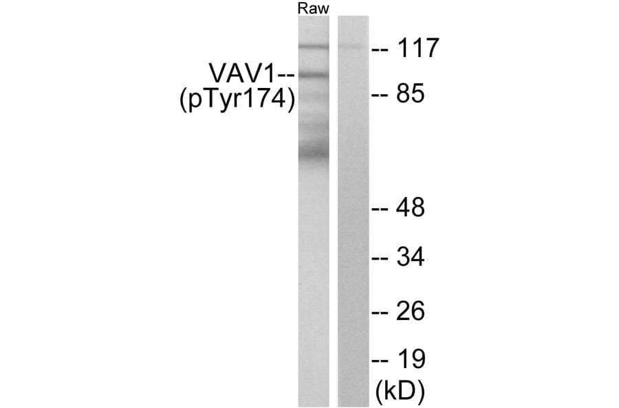 Western Blot - Anti-VAV1 (phospho Tyr174) Antibody (A7251) - Antibodies.com