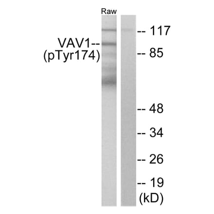 Western Blot - Anti-VAV1 (phospho Tyr174) Antibody (A7251) - Antibodies.com