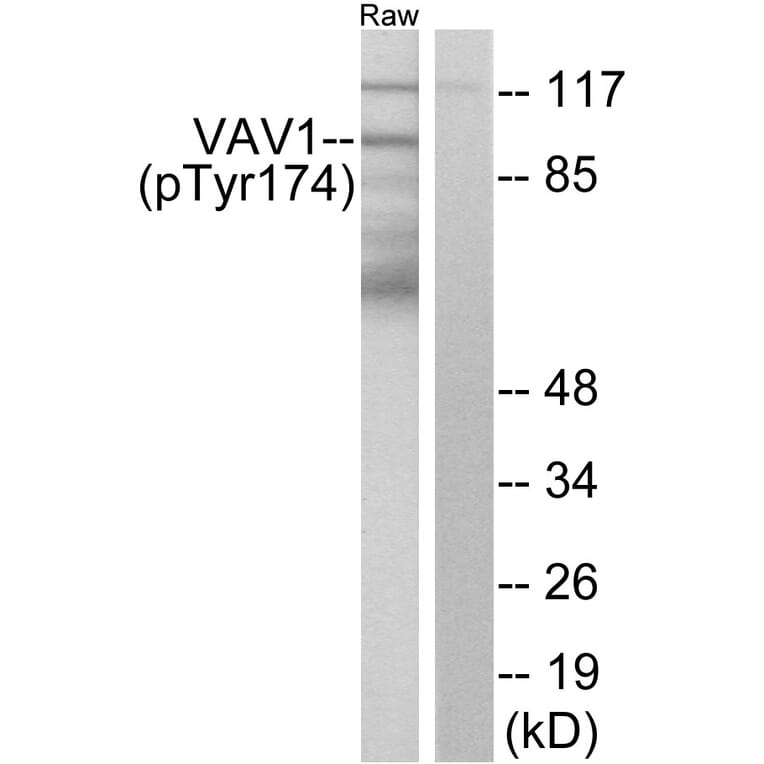 Western Blot - Anti-VAV1 (phospho Tyr174) Antibody (A7251) - Antibodies.com