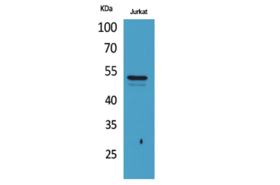 Western Blot - Anti-TUBA1A (acetyl Lys40) Antibody (D12202) - Antibodies.com