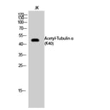 Western Blot - Anti-TUBA1A (acetyl Lys40) Antibody (D12202) - Antibodies.com