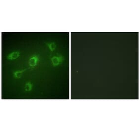 Immunofluorescence - Anti-TGF beta Receptor III Antibody (C0339) - Antibodies.com