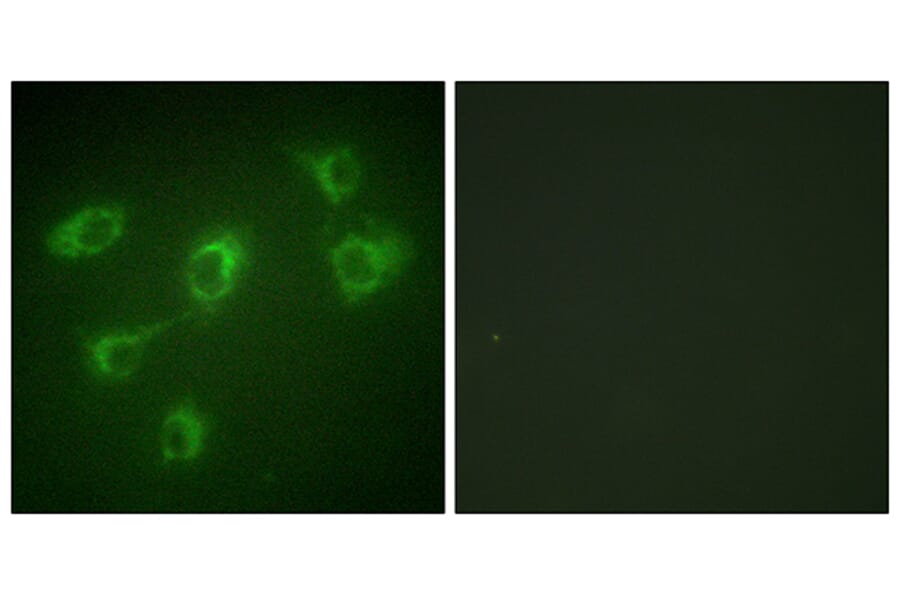 Immunofluorescence - Anti-TGF beta Receptor III Antibody (C0339) - Antibodies.com