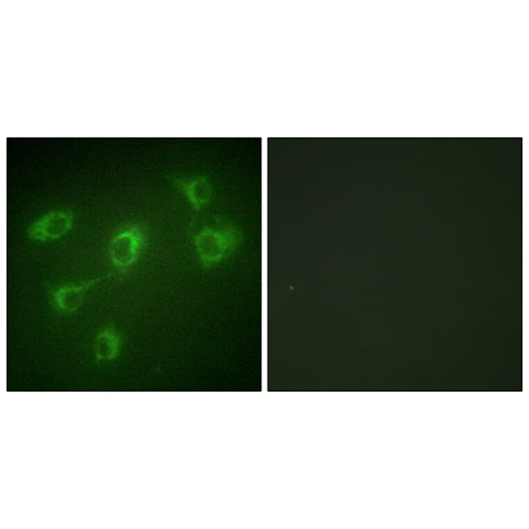 Immunofluorescence - Anti-TGF beta Receptor III Antibody (C0339) - Antibodies.com