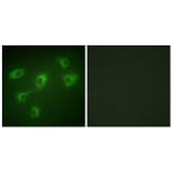 Immunofluorescence - Anti-TGF beta Receptor III Antibody (C0339) - Antibodies.com