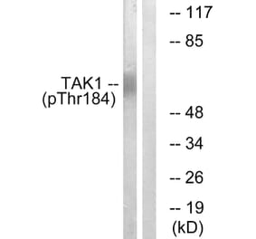 Western Blot - Anti-TAK1 (phospho Thr184) Antibody (A1123) - Antibodies.com