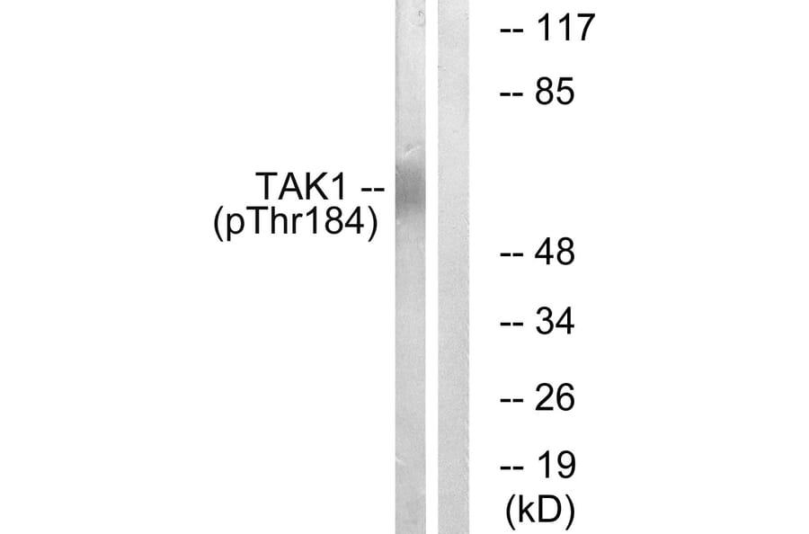 Western Blot - Anti-TAK1 (phospho Thr184) Antibody (A1123) - Antibodies.com