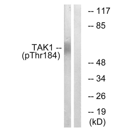 Western Blot - Anti-TAK1 (phospho Thr184) Antibody (A1123) - Antibodies.com