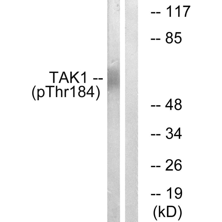 Western Blot - Anti-TAK1 (phospho Thr184) Antibody (A1123) - Antibodies.com