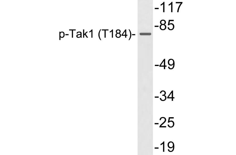 Western Blot - Anti-Tak1 (phospho Thr184) Antibody (P12-1057) - Antibodies.com
