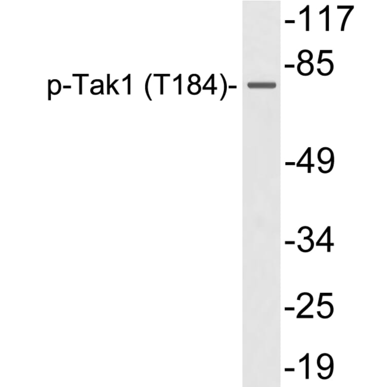 Western Blot - Anti-Tak1 (phospho Thr184) Antibody (P12-1057) - Antibodies.com