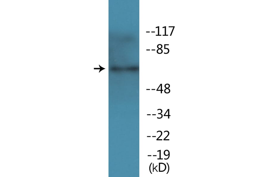 Western Blot - Anti-TAK1 (phospho Thr184) Antibody (P12-1185) - Antibodies.com