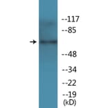 Western Blot - Anti-TAK1 (phospho Thr184) Antibody (P12-1185) - Antibodies.com