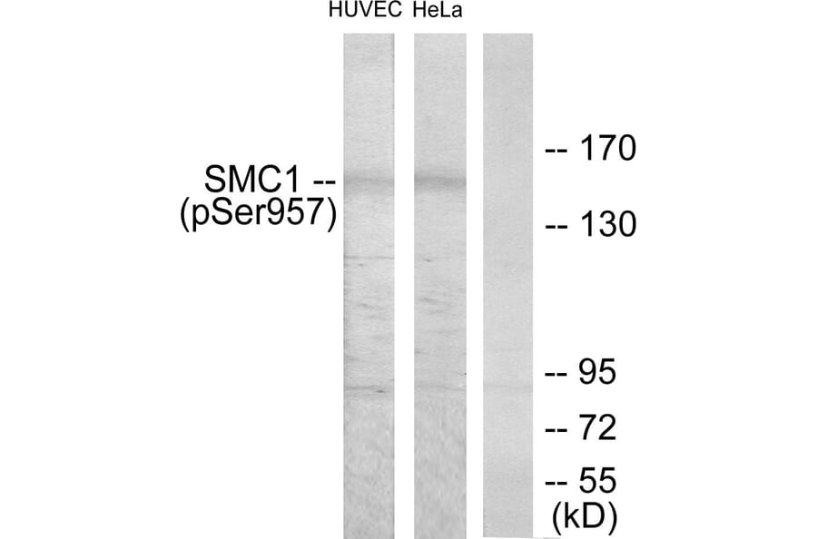Western Blot - Anti-SMC1 (phospho Ser957) Antibody (A7217) - Antibodies.com