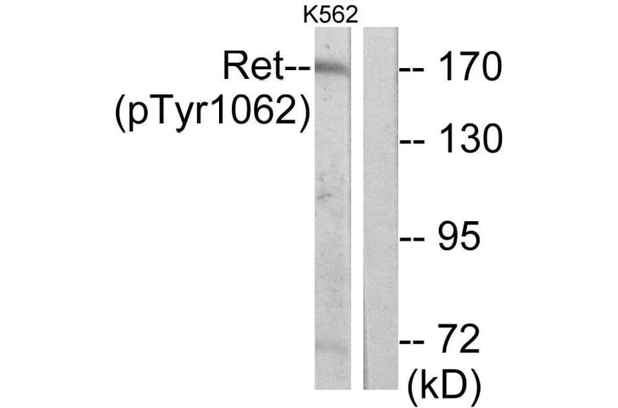 Western Blot - Anti-Ret (phospho Tyr1062) Antibody (A7213) - Antibodies.com