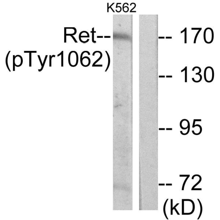 Western Blot - Anti-Ret (phospho Tyr1062) Antibody (A7213) - Antibodies.com