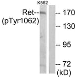 Western Blot - Anti-Ret (phospho Tyr1062) Antibody (A7213) - Antibodies.com