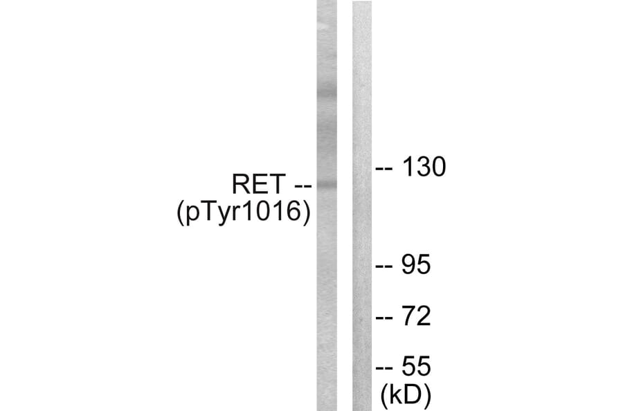 Western Blot - Anti-Ret (phospho Tyr1015) Antibody (A0567) - Antibodies.com