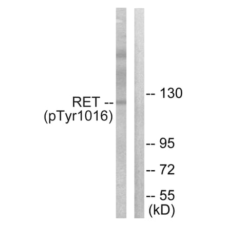 Western Blot - Anti-Ret (phospho Tyr1015) Antibody (A0567) - Antibodies.com