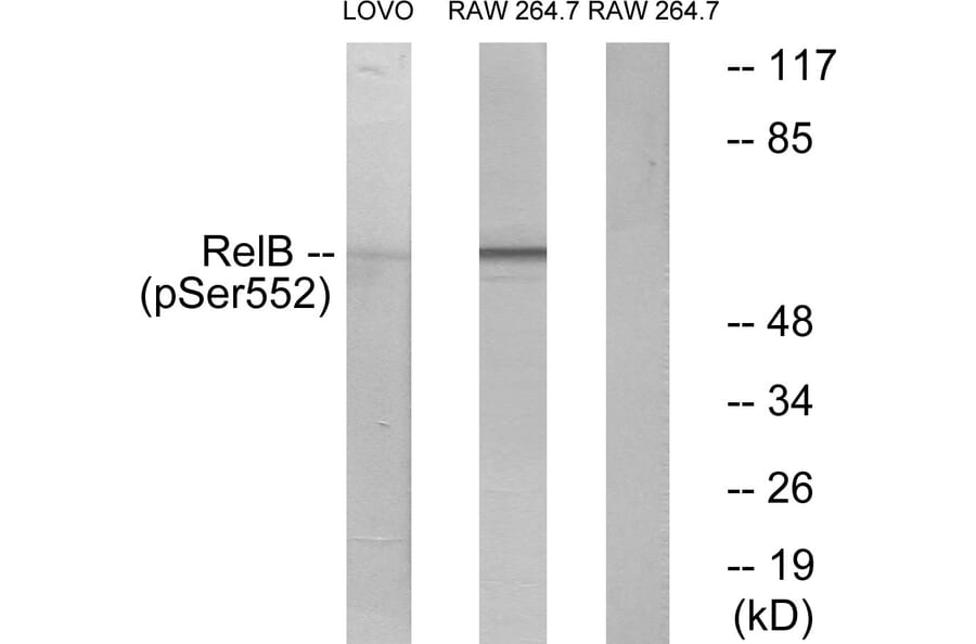 Western Blot - Anti-RelB (phospho Ser552) Antibody (A7212) - Antibodies.com