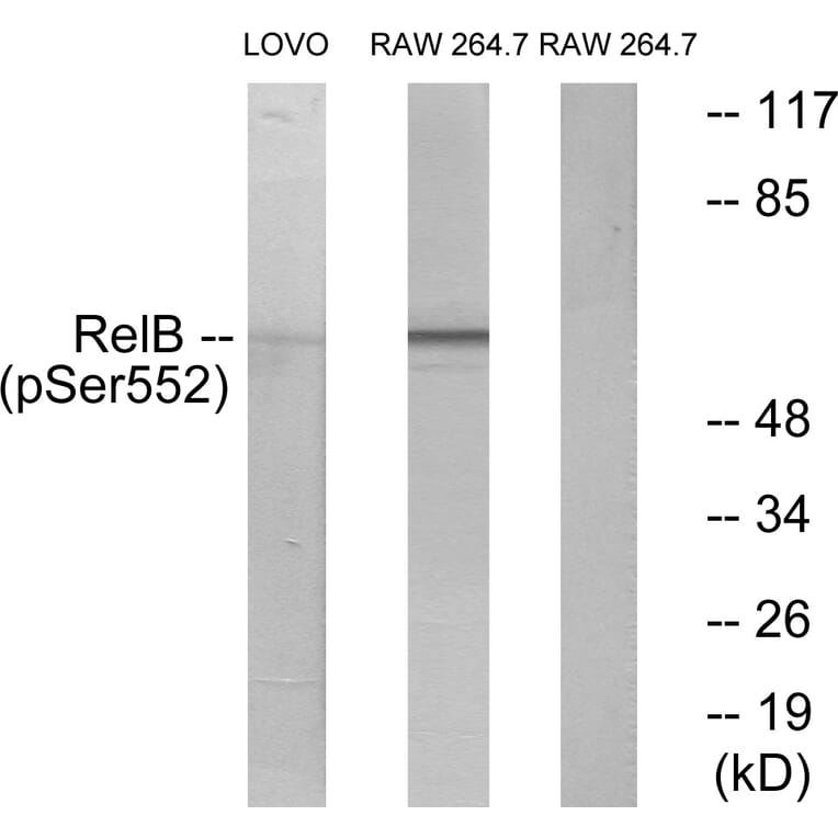 Western Blot - Anti-RelB (phospho Ser552) Antibody (A7212) - Antibodies.com