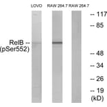 Western Blot - Anti-RelB (phospho Ser552) Antibody (A7212) - Antibodies.com