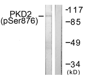 Western Blot - Anti-PKD2 (phospho Ser876) Antibody (A0808) - Antibodies.com