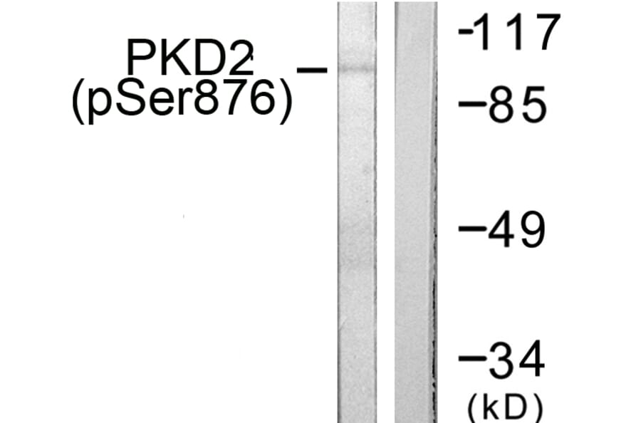 Western Blot - Anti-PKD2 (phospho Ser876) Antibody (A0808) - Antibodies.com