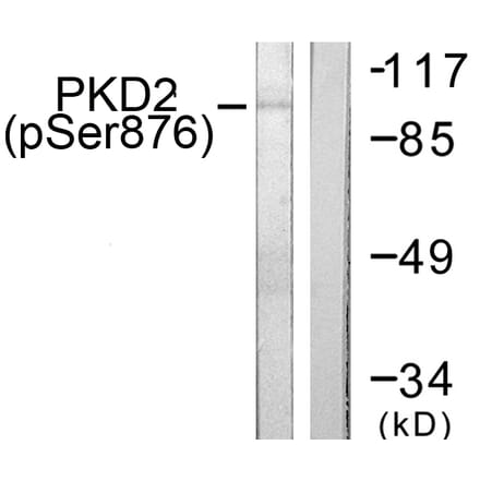 Western Blot - Anti-PKD2 (phospho Ser876) Antibody (A0808) - Antibodies.com