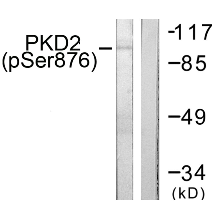 Western Blot - Anti-PKD2 (phospho Ser876) Antibody (A0808) - Antibodies.com