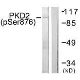 Western Blot - Anti-PKD2 (phospho Ser876) Antibody (A0808) - Antibodies.com