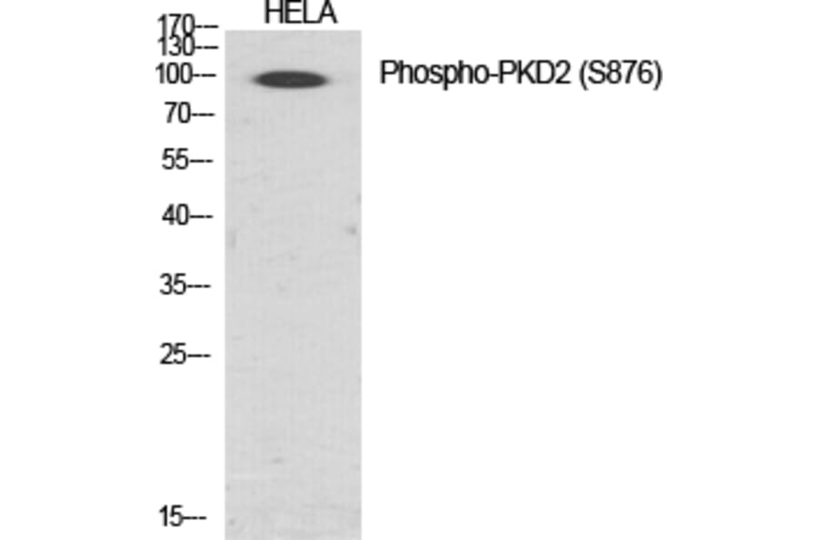 Western Blot - Anti-PKD2 (phospho Ser876) Antibody (A0808) - Antibodies.com