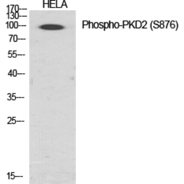 Western Blot - Anti-PKD2 (phospho Ser876) Antibody (A0808) - Antibodies.com