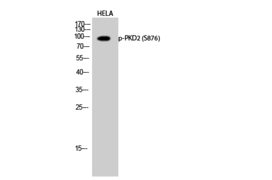 Western Blot - Anti-PKD2 (phospho Ser876) Antibody (A0808) - Antibodies.com