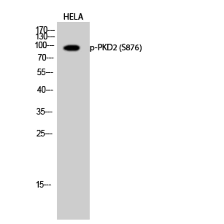 Western Blot - Anti-PKD2 (phospho Ser876) Antibody (A0808) - Antibodies.com
